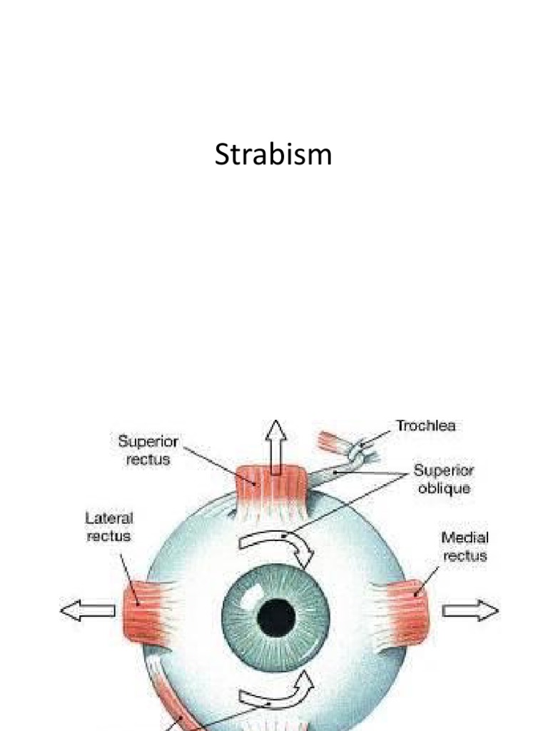 Strabism A | PDF