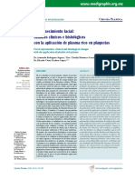 rejuvenicimento facial plasma rico en plaquetas.pdf