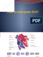 How to interpret ECG rhythms