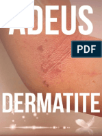 Dermatite: tipos, sintomas e tratamentos