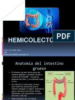 HEMICOLECTOMÍA