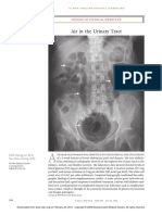 Air in The Urinary Tract: Images in Clinical Medicine