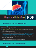 Hepatocellular Carcinoma: T L A M