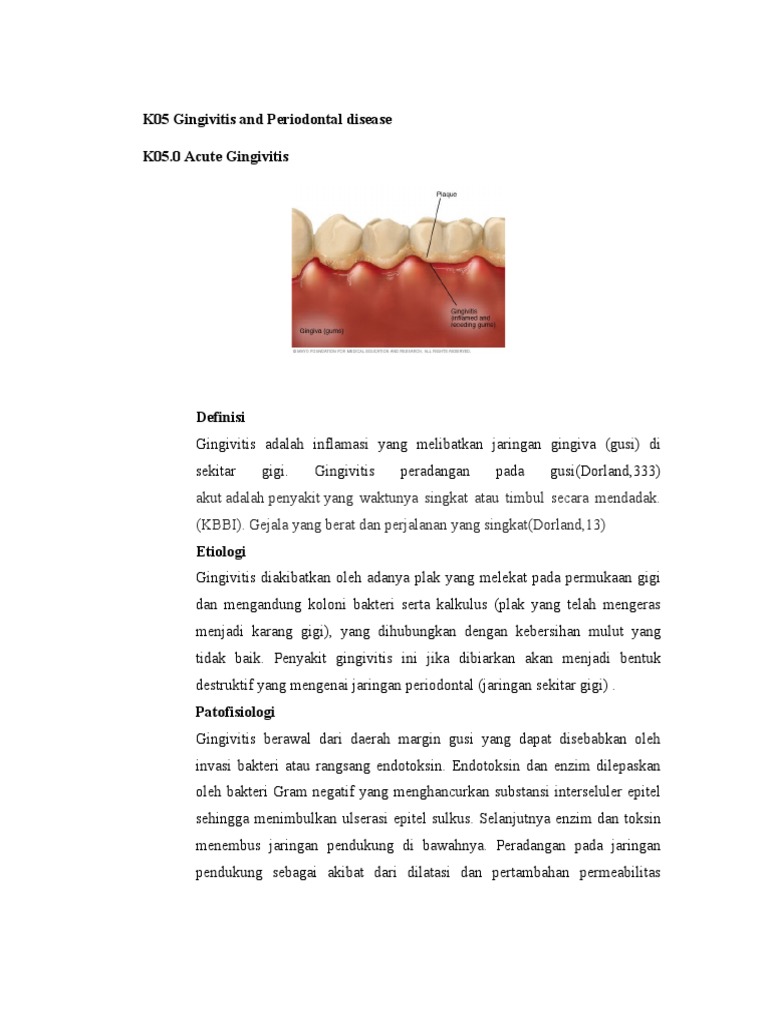 Penyakit Gingivitis dan Periodontitis | PDF