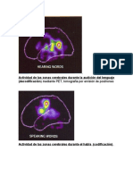 Actividad de Las Zonas Cerebrales Del Lenguaje Mediante PET