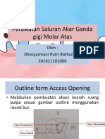 Perawatan Saluran Akar Ganda Gigi M1 RA