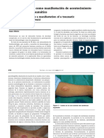 Dermatitis Facticia Como Manifestación de Trauma Psicológico