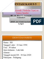 Nyeri Kepala (Vascular Type) Ec Tumor Serebri