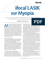 Multifocal LASIK for Myopia