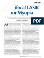 Multifocal LASIK For Myopia