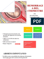 Hemorragia Del 1trimestre