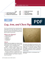 Leg, Arm, and Chest Papules: ERM ASE