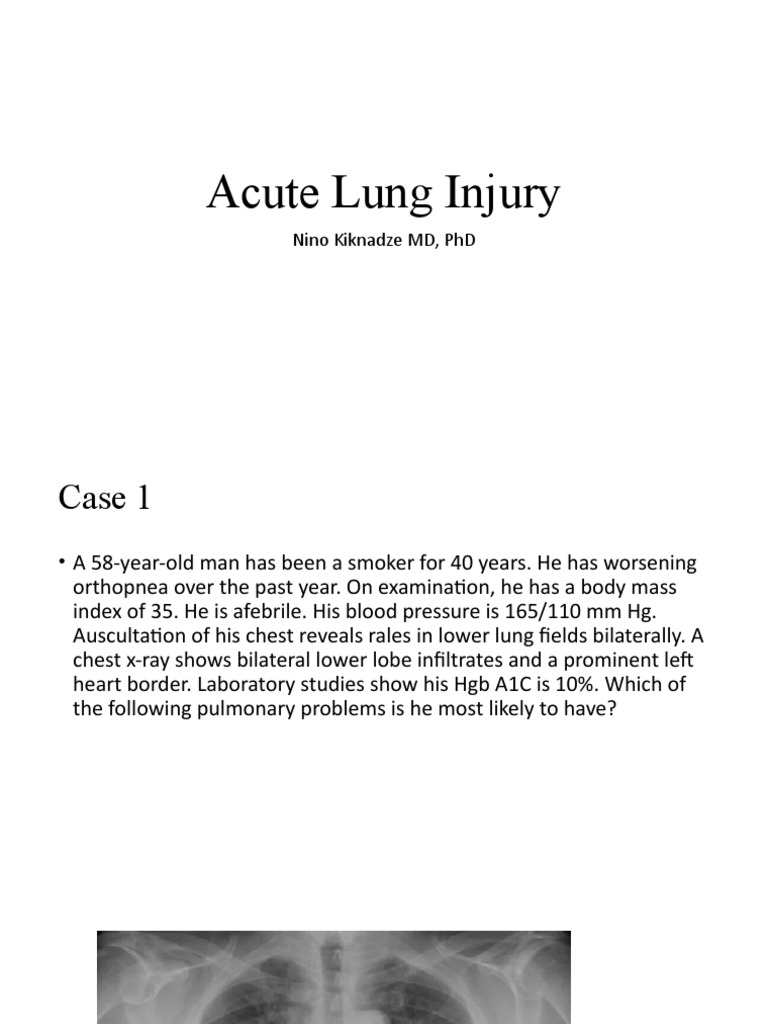 Acute Lung Injury | PDF | Pneumonia | Respiratory System