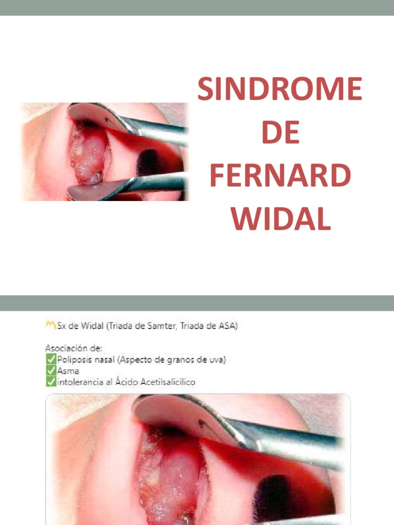 SINDROME DE FERNARD WIDAL Up PDF