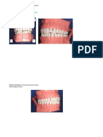 Odontogramas