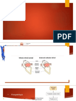 Cardiopatia isquemica, valvulopatias y arritmias. PARTE 5pptx.pptx