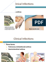 Clinical Infections: Three Forms