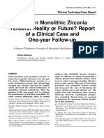 Ultrathin Monolithic Zirconia Veneers: Reality or Future? Report of A Clinical Case and One-Year Follow-Up