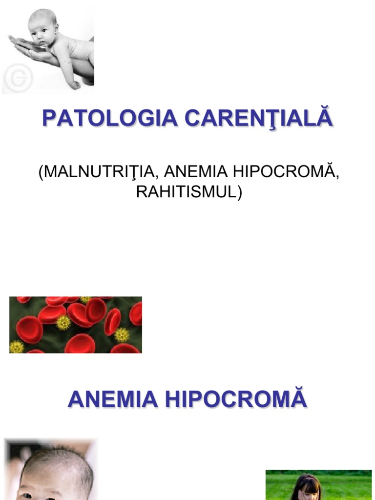 Patologie Carentiala (Anemii, Rahitism) PDF | PDF