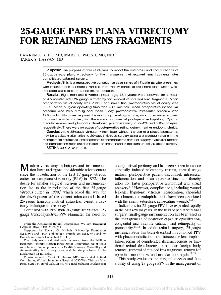 25Gauge PPV For Retained Lens Fragments PDF Cataract Eye
