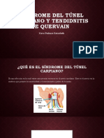 Síndrome Del Túnel Carpiano y Tendidnitis de Quervain