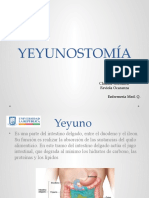 Yeyunostomia
