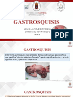 GASTROSQUISIS