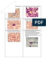 Hematologi