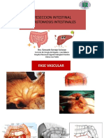 Reseccion Intestinal PDF