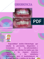 PERIODONCIA