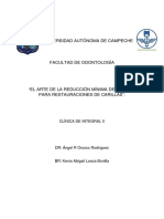 El Arte de La Reducción Mínima de Dientes para Restauraciones de Carillas