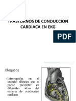 Trastornos de Conduccion Cardiaca en Ekg