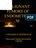 Malignant Tumors of Endometriu M: Powerpoint Templates