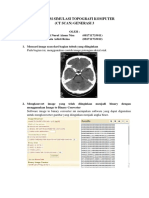 CT Scan Generasi 3 - Siti Nurul Ainun (081711733011) - Sinta Adisti Reina (081711733012)