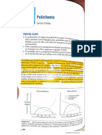 Policitemia del Recien Nacido