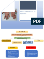 MAPA CONCEPTUAL de Cianosis 