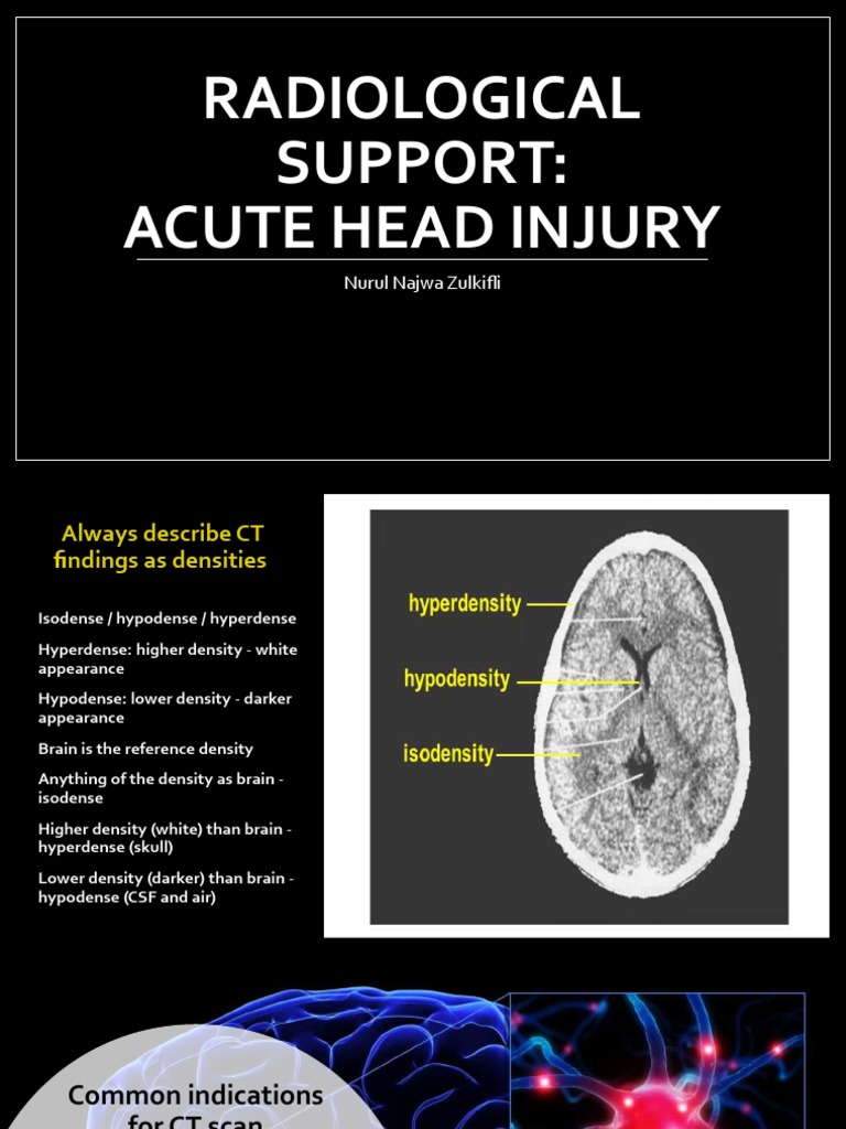 Acute Head Injury CT Guide | PDF | Skull | Central Nervous System