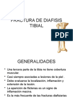 Fractura de Diafisis Tibial