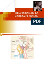 Fracturas de La Cabeza Femoral