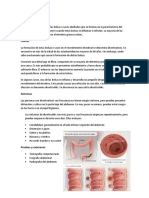 Diverticulitis