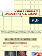 Maformatii, Traumatisme Rinosinusale, Corpi Straini