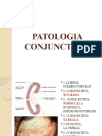 PATOLOGIA CONJUNCTIVEI.pptx