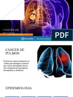 cancer de pulmon.pptx
