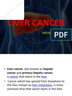 Liver Cancer: Ratheesh R L