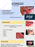 ESTOMATITIS