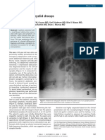 Bowel Loops and Eyelid Droops Case