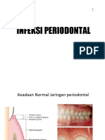 Infeksi Periodontal