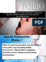 Polimyelitis