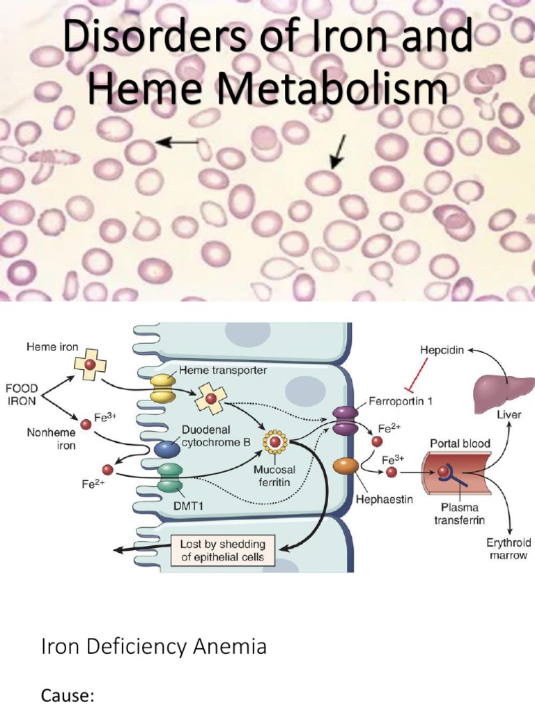 Disorders of Iron and Heme Metabolism PDF Anemia Biochemistry