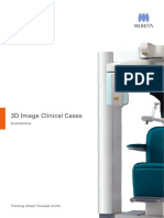 3D Image Clinical Cases: Endodontics